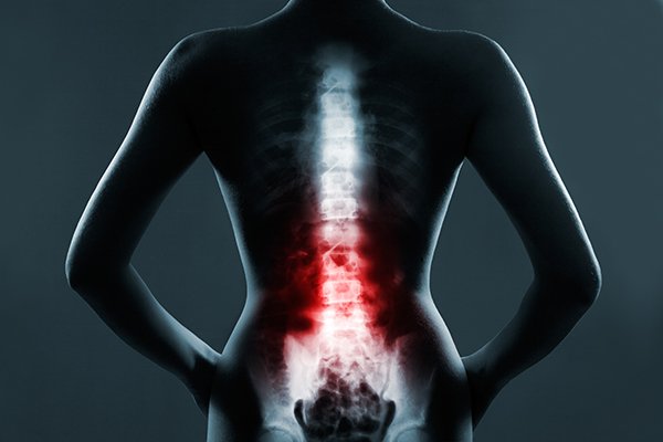 Effects Of Spine Problems